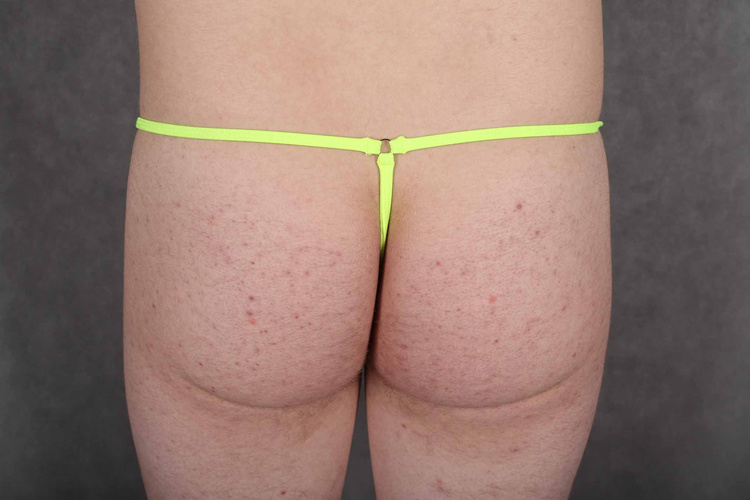 Men's Open  Thong 509-1